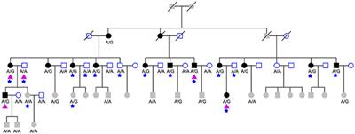 Identification of the CFTR c.1666A>G Mutation in Hereditary Inclusion Body Myopathy Using Next-Generation Sequencing Analysis